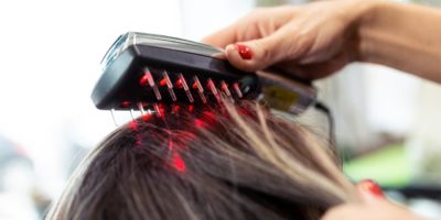 Terapia de luz LED para estimular el crecimiento capilar